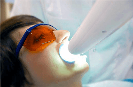 Understanding the Causes of Teeth Sensitivity Dartford