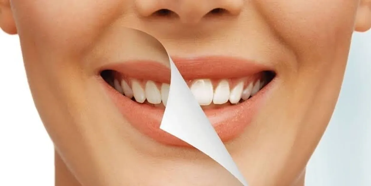 What Is Cosmetic Dentistry and How Can It Transform Your Smile Dartford