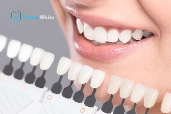 How to Maximise the Results of Your Laser Teeth Whitening Treatment Dartford