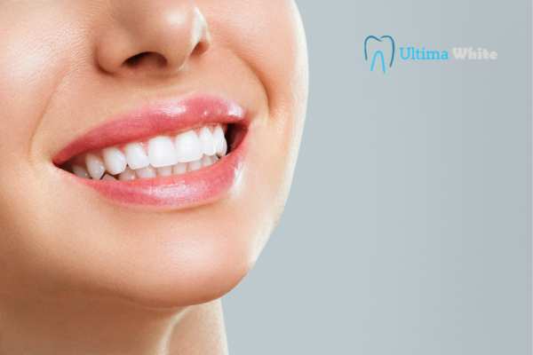 So, Which Teeth Whitening Option Is Better