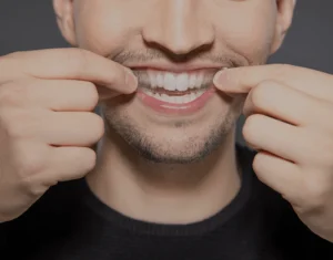 Overview of Home Teeth Whitening Kits Dartford