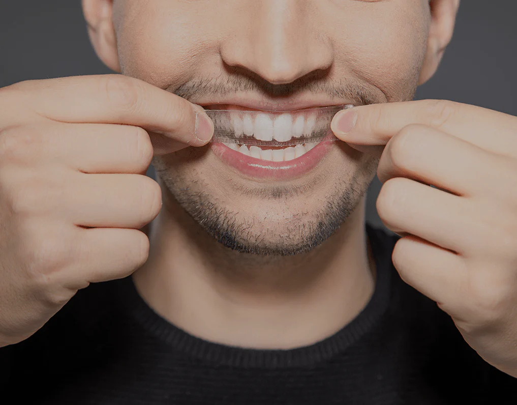 How Are Invisible Aligners Changing Orthodontic Treatments Dartford?