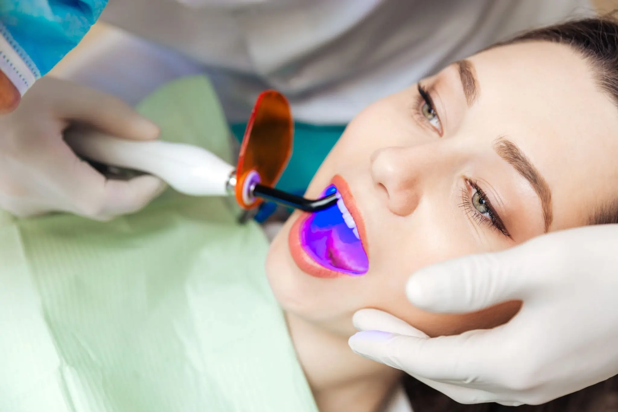 What You Need to Know Before Brightening Your Smile Dartford