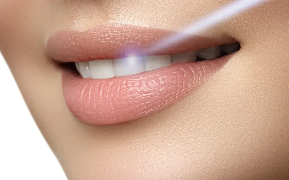 Understanding Teeth Whitening Risks and Results Dartford