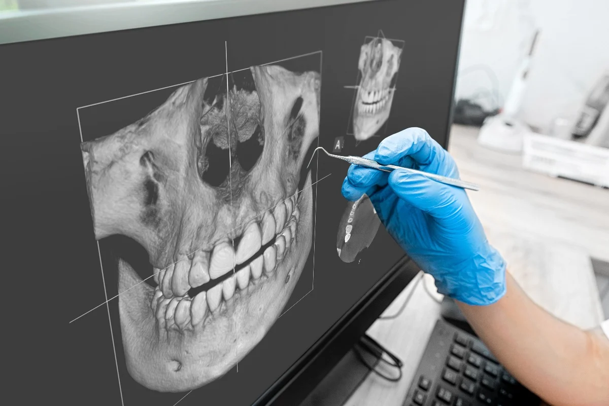 Key Benefits of 3D Printing for Patients and Dentists Dartford