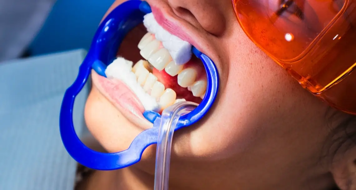 How Can Cosmetic Dentistry Boost Your Confidence Dartford