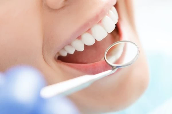 How Much Fluoride Do You Really Need Dartford?