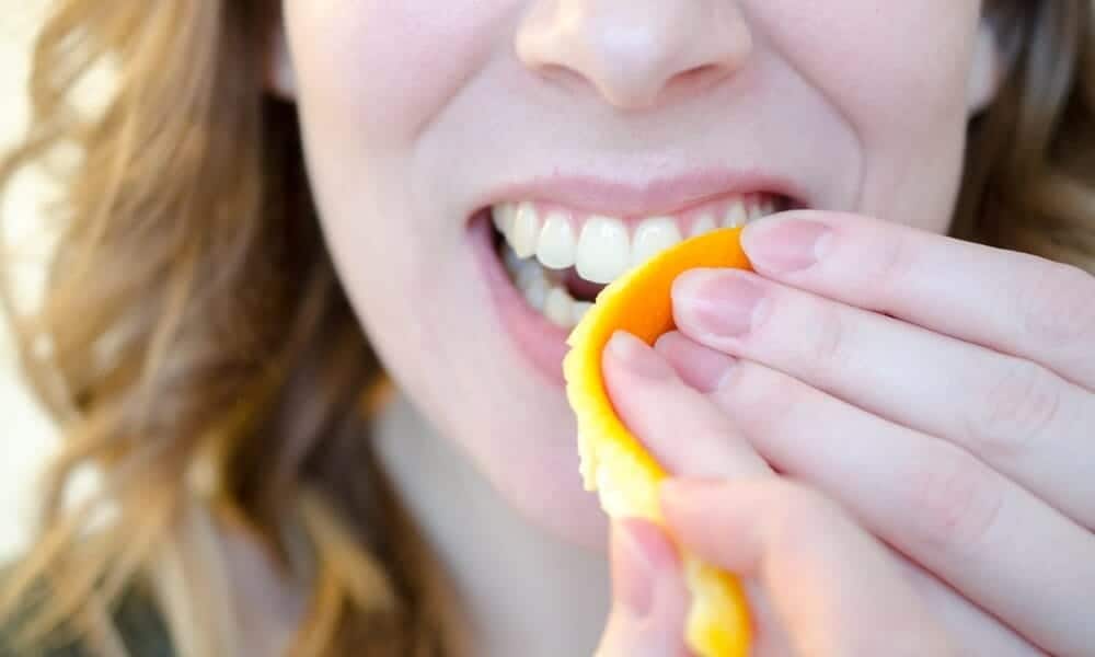 Signs Your Teeth Are Being Damaged by Acid Dartford