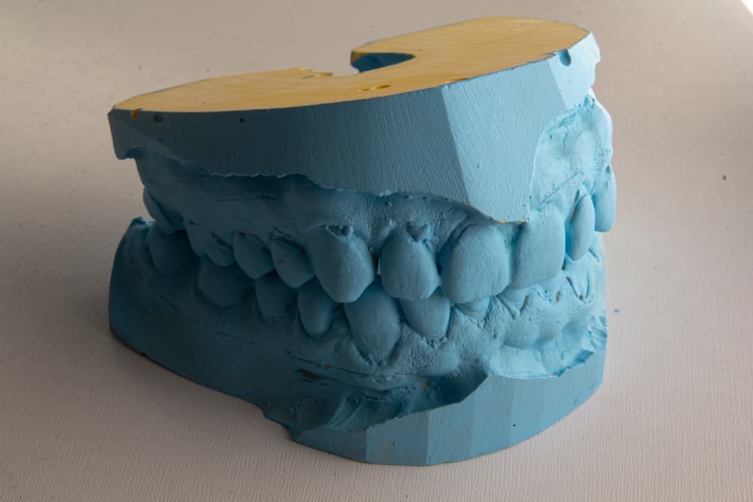 How Do Dental Implants Improve Jawbone Health and Oral Function Dartford?