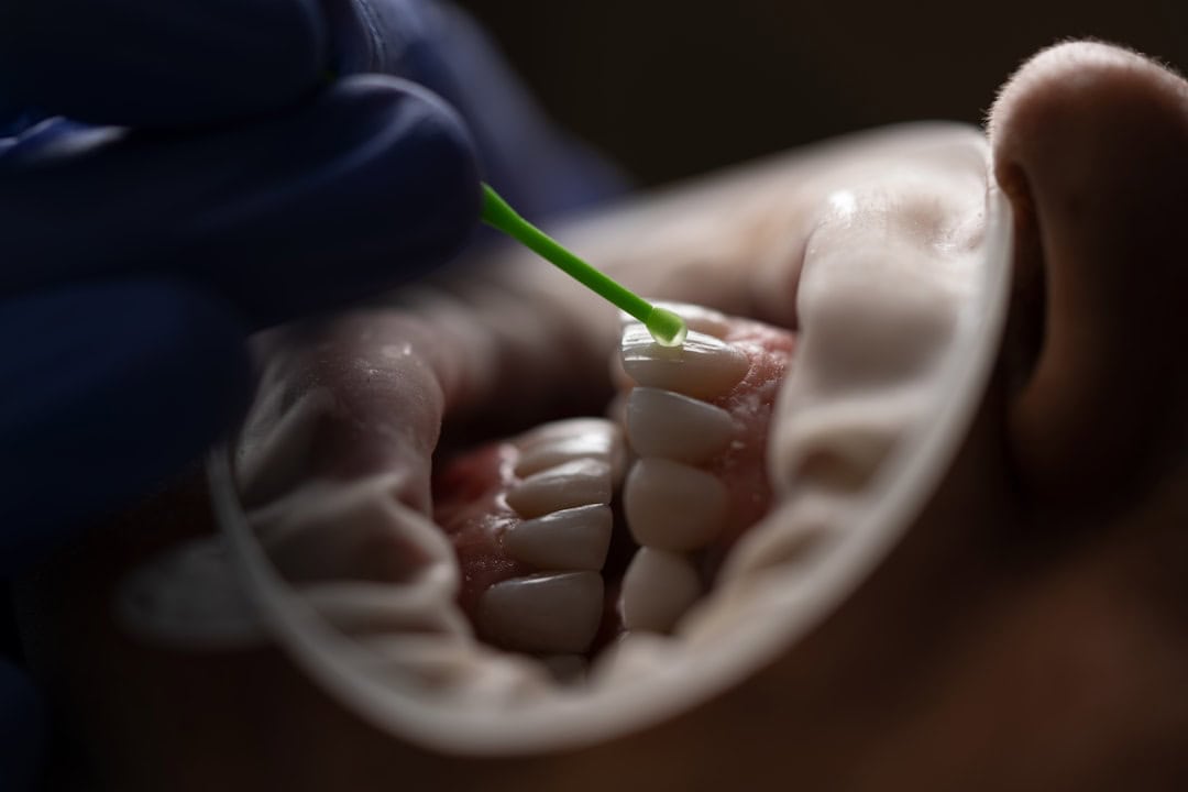 The Role of Saliva: Nature’s Defense System Dartford