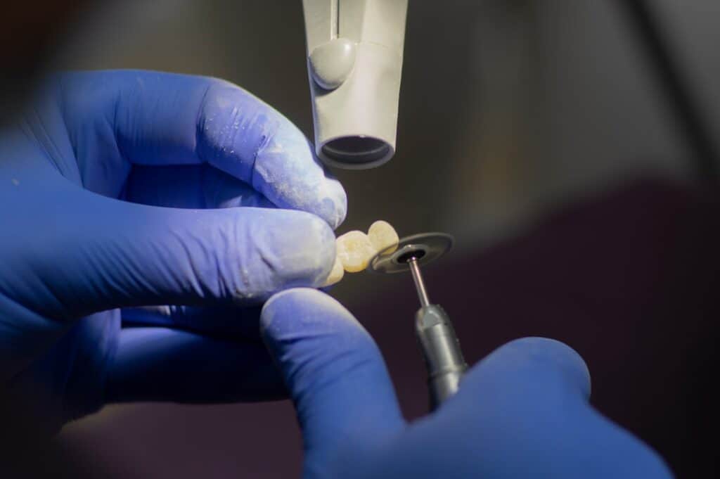 Customised Dental Solutions: Crowns, Aligners, and Implants Dartford