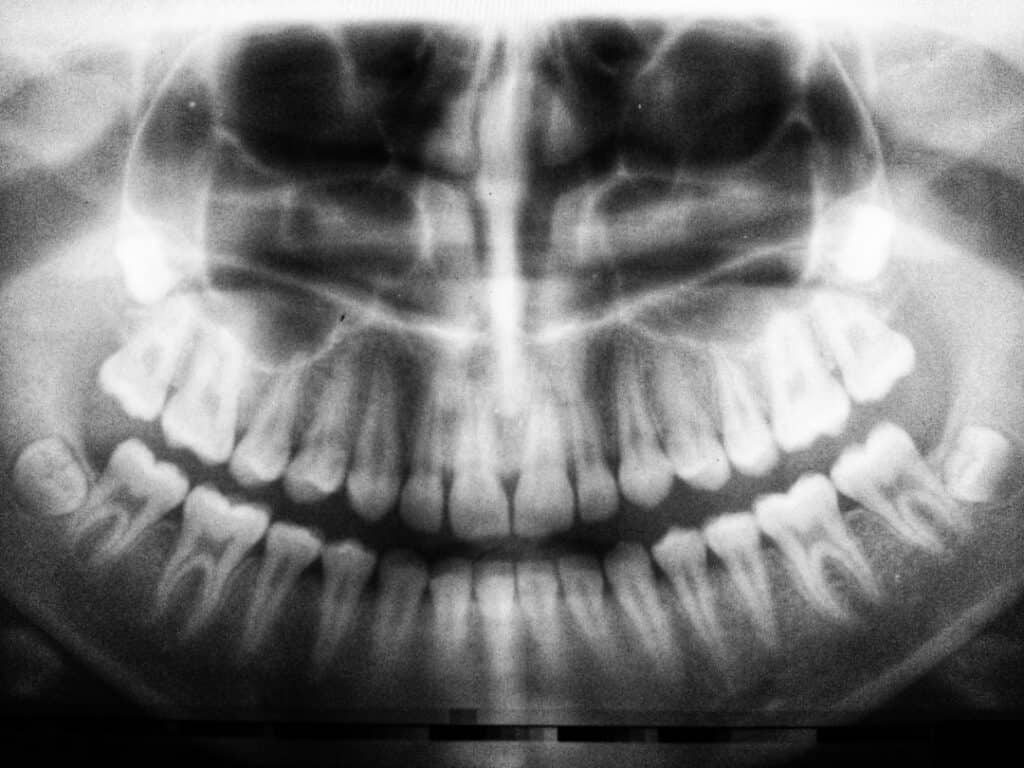 The Future of 3D Printing in Oral Healthcare Dartford